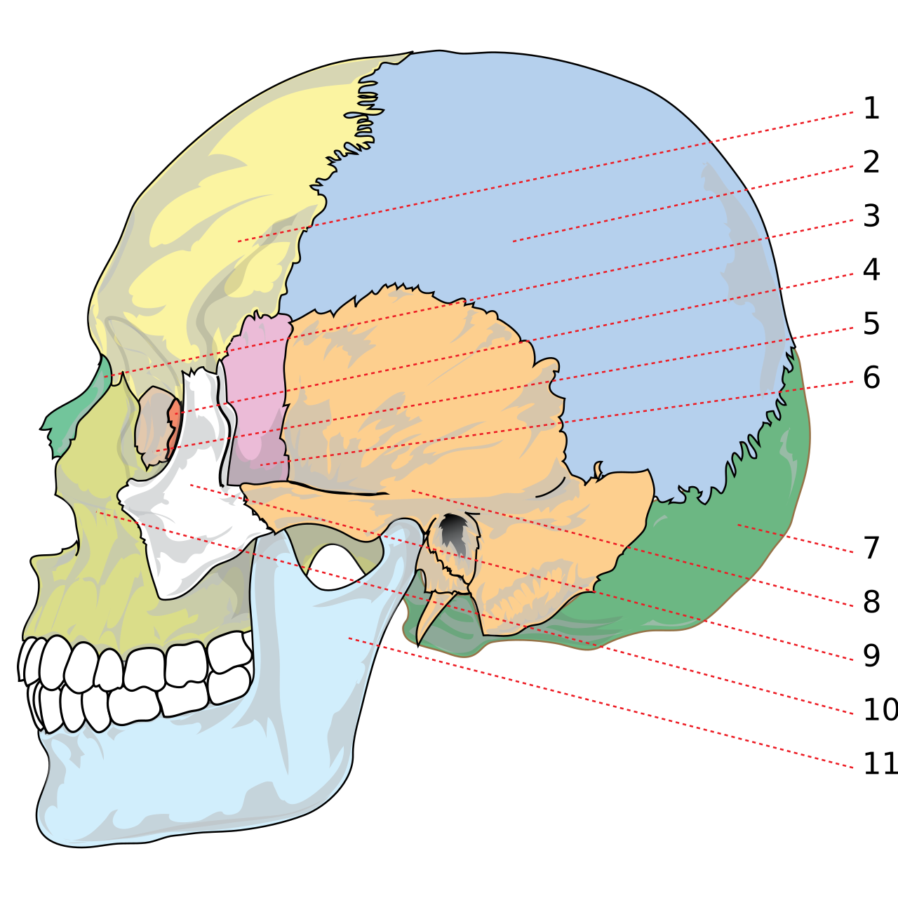 Basilar skull fracture